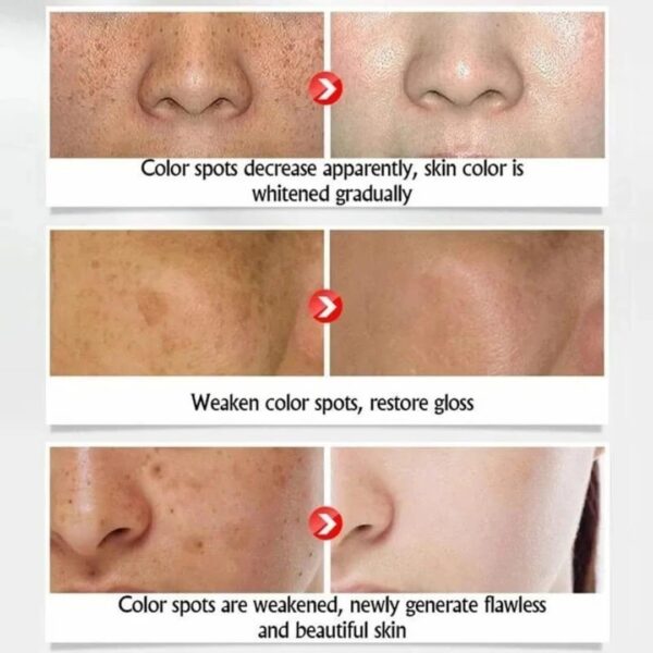 Rores Rice serum Rice skin Beauty Essence - Image 3
